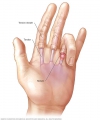 Pain In Middle And Ring Finger Left Hand