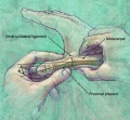 Testing du ligament collateral ulnaire (LLI)