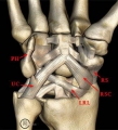 Anatomie osseuse du poignet et de la main - Membre-Superieur