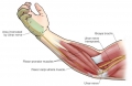 de compression nerf cubital - Dr Fontes Chirurgien de la spécialisé dans le sport de haut niveau