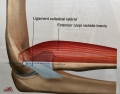 Tendinite du coude (épicondylite) : comment la soigner ?