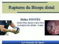 Notre technique de réparation endoscopique du biceps brachial chez le sportif